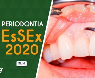 Periodontia EsSEx 2020